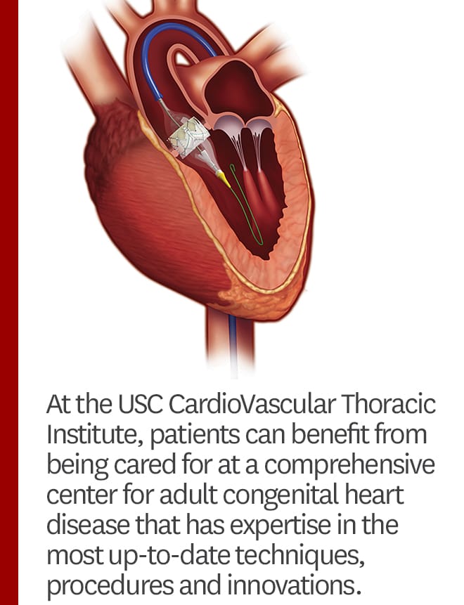 cardio-vascular-thoracic-institute-keck-medicine-usc-techniques